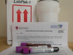 When you are accepted as a volunteer, you will receive a pack like this. It feels great to  be able to send the blood sample off to the researchers to help find a cure for Anorexia Nervosa.